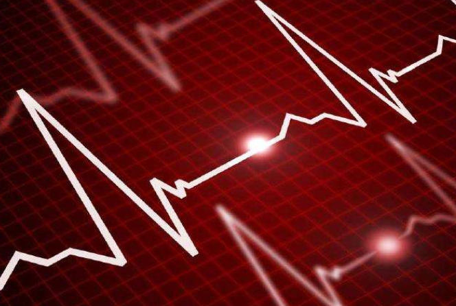 心律失常輕重的區(qū)分你了